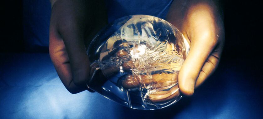 Ενδοπροσθετική σιλικόνη